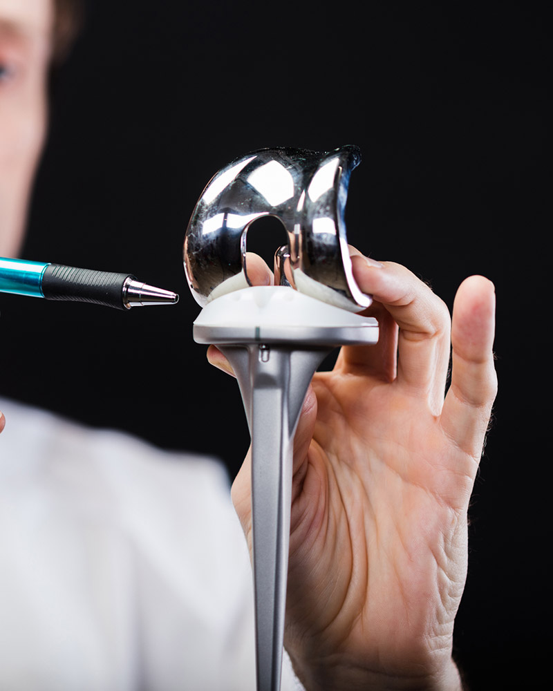 Knee Replacement Surgery in Brisbane I Orthopaedics I St Vincent’s